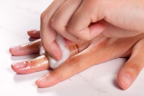 ways to remove mehndi stains