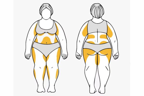 hormones and weight gain in women