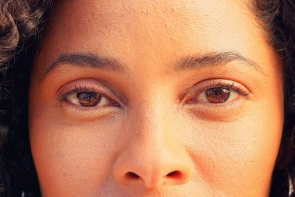 how to reduce eye puffiness