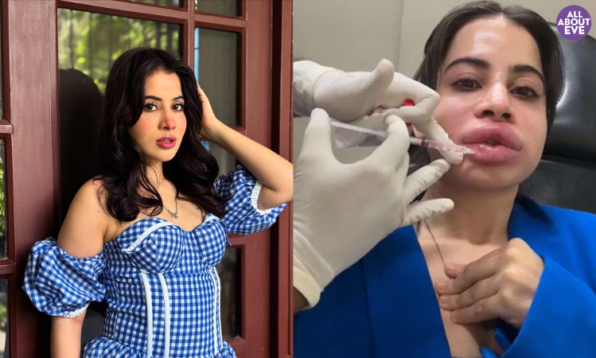 urfi javed lip fillers