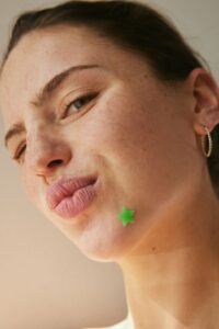 do pimple patches work