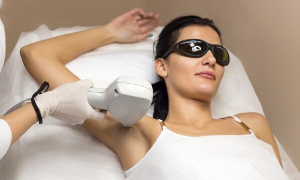 laser hair reduction
