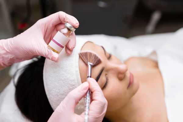 chemical peeling treatments