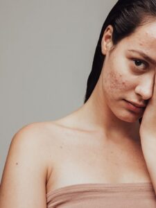 bridal skincare routine at home