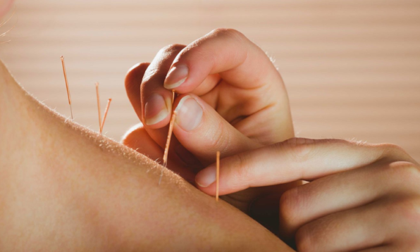 acupuncture for period pain