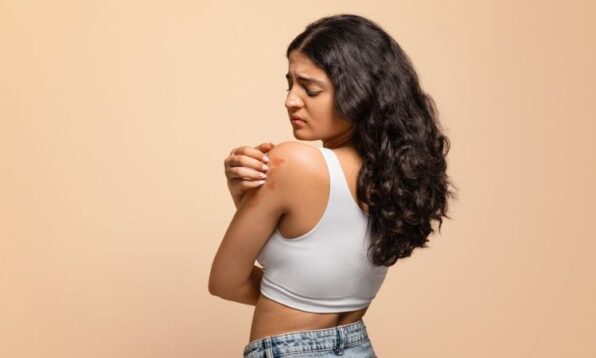 damaged skin barrier body